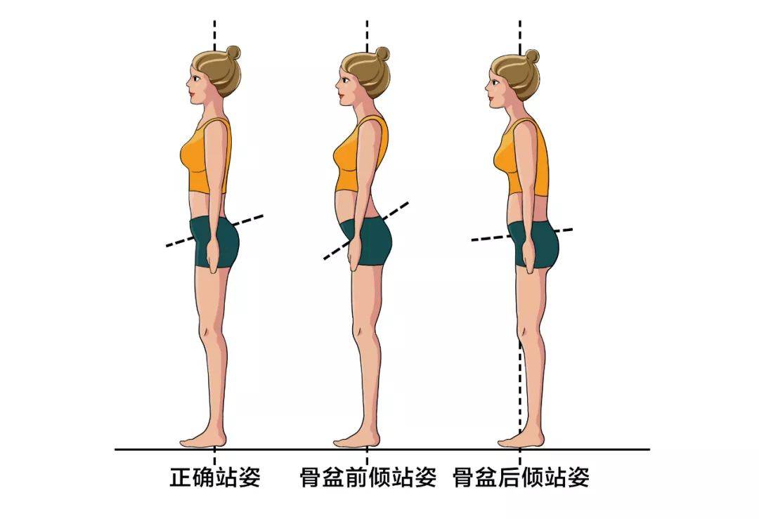 不良体态纠正攻略,告别短信脖及骨盆前倾 | 健康日历_手机搜狐网