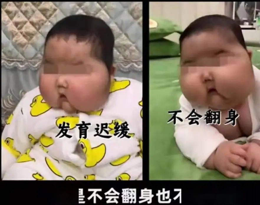 孩子额头汗毛重怎么办