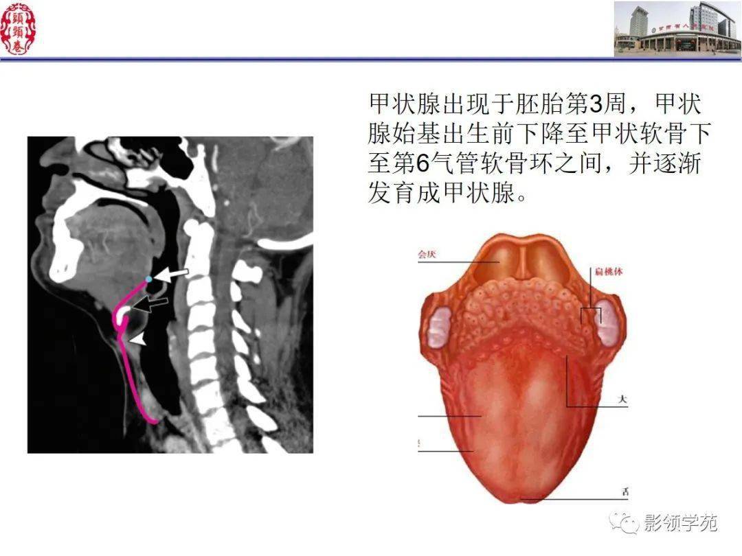 舌,口底影像解剖及常见疾病诊断