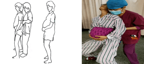 助产干货:悬垂腹分娩,全流程多体位分步骤指导!