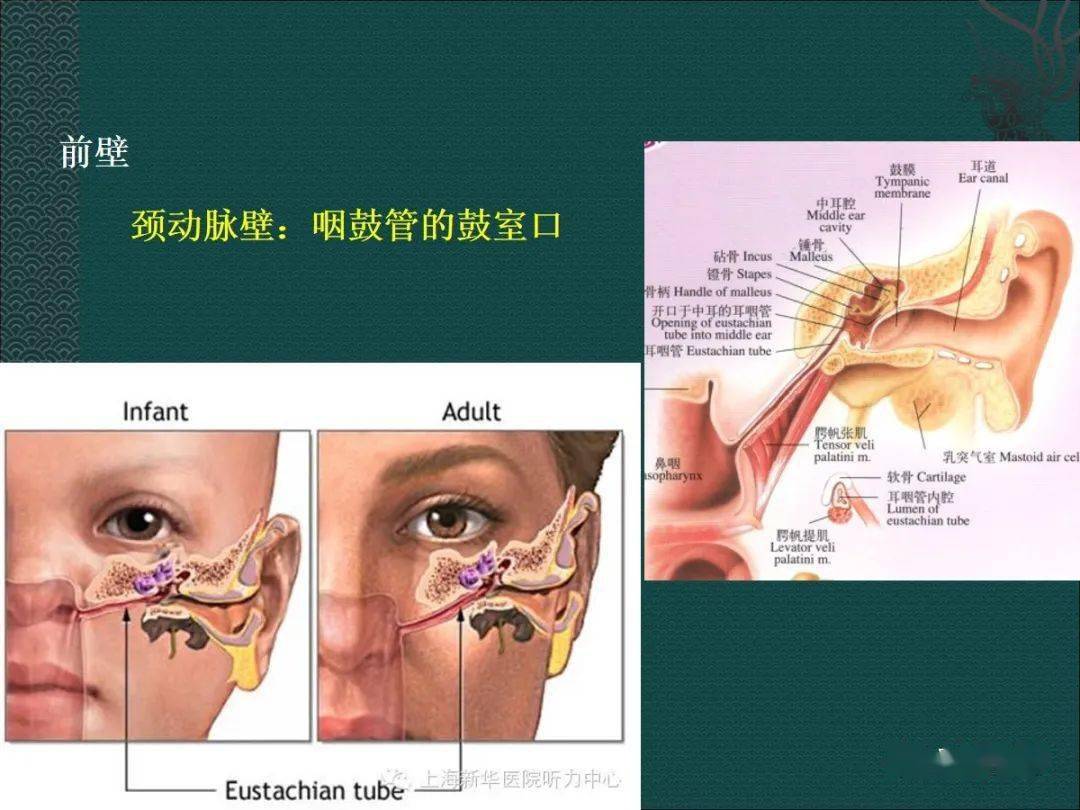 耳解剖及常见疾病影像表现