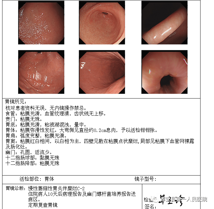 毕医生则耐心地告诉患者,胃肠镜检查并没有想象中那么可怕,  "真是睡