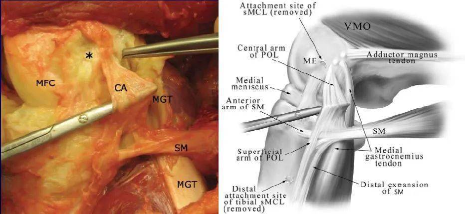 膝关节解剖图解_韧带