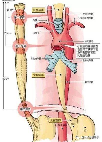 三个生理性狭窄: 食管入口 左主支气管 通过膈肌裂孔处