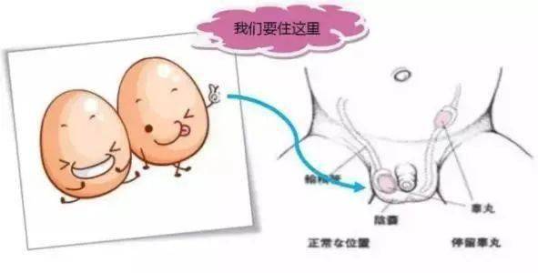 徐晓龙副主任医师介绍道,正常男孩都有2个"蛋蛋",但如果睾丸未能按