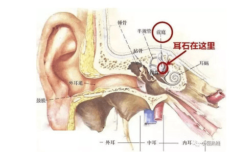 名医话健康|耳石症,是耳朵里长石头了吗?