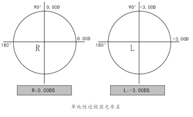 【最全科普】屈光参差的成因,影响,如何配镜都在这里!