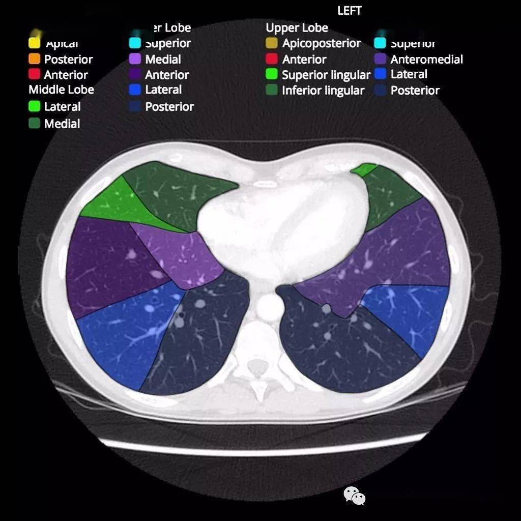 ct肺段解剖(图)