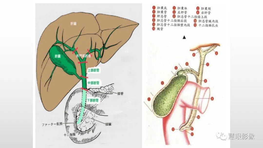 胆道解剖及先天变异