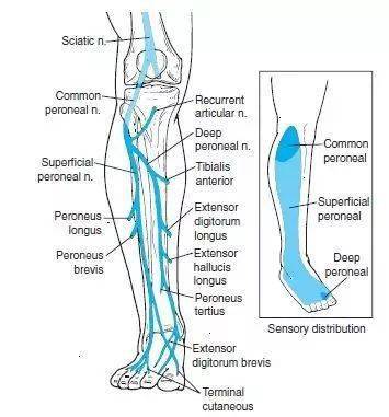摆动期髋关节过度屈曲(跨阈步态)使脚趾离地 腓总神经的感觉运动支配