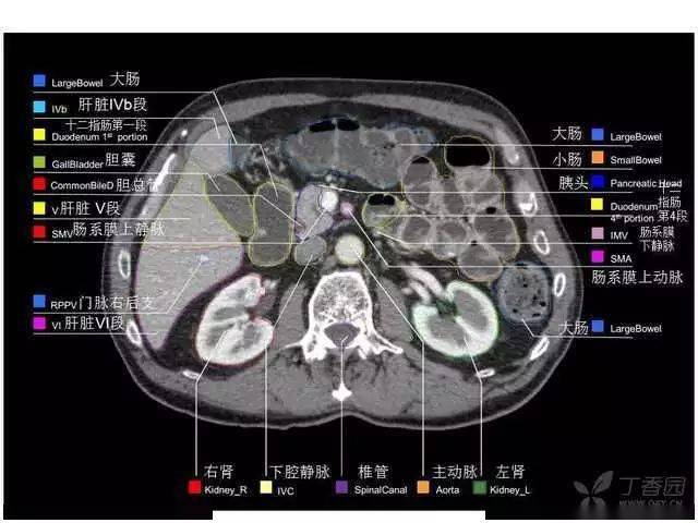 收藏史上最全的ct断层解剖图谱一篇所有都有