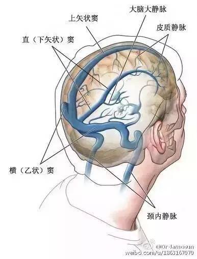 收藏必备超详脑供血系统分类