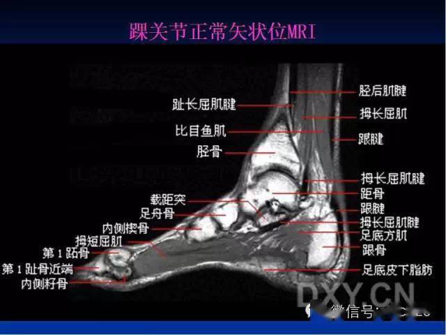 收藏| 最全面踝关节正常mri解剖