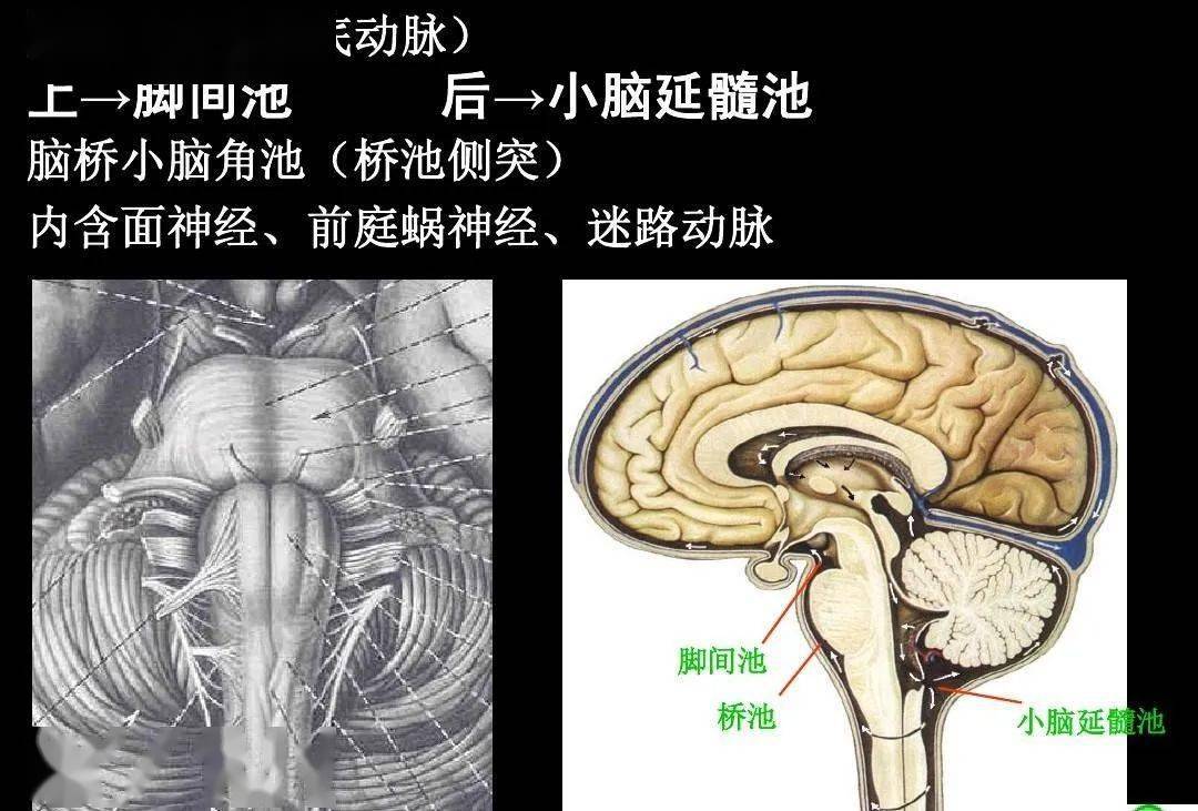高清解剖脑室脑池脑膜