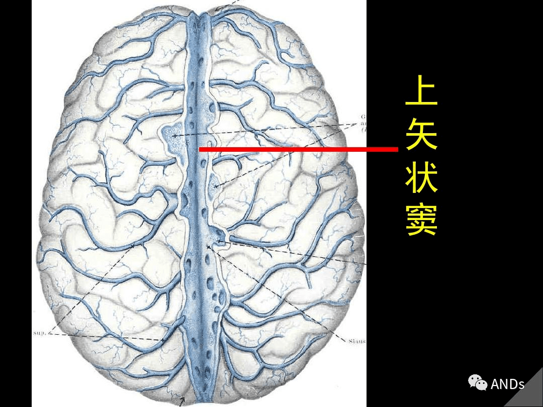 高清解剖:脑室/脑池/脑膜