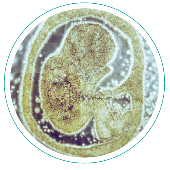 中外微生物培养皿作品鉴赏-微美艺术火花的碰撞