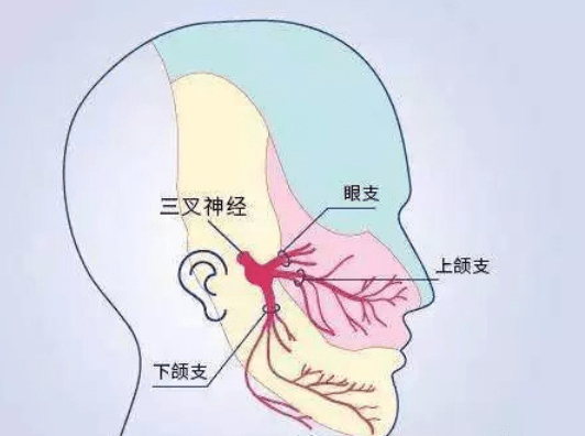 疼痛之王-三叉神经痛