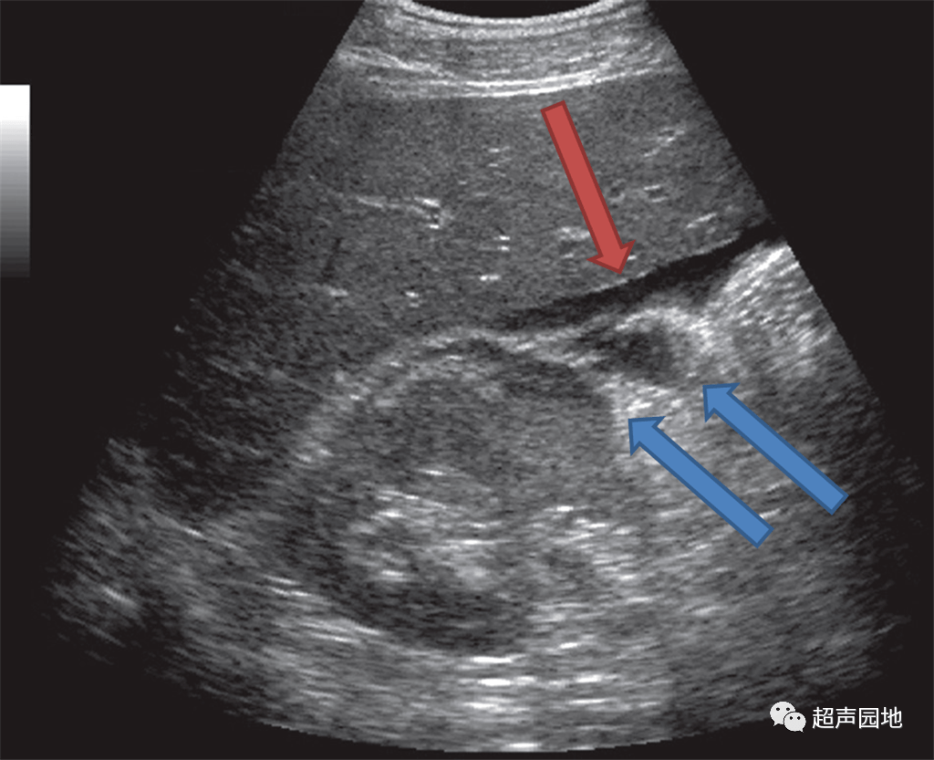 欢迎关注【超声园地,一起巩固超声基础知识!