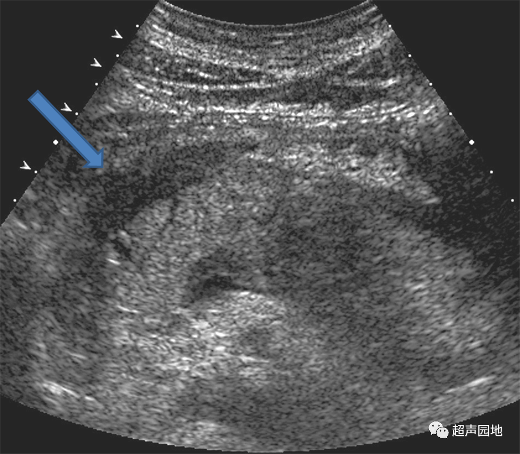 欢迎关注【超声园地,一起巩固超声基础知识!
