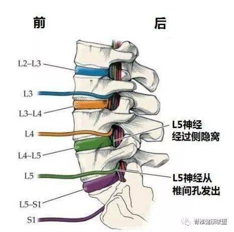 炎症反应,韧带,骨膜,纤维环,脊髓或神经根外的窦椎神经受到这双重打击