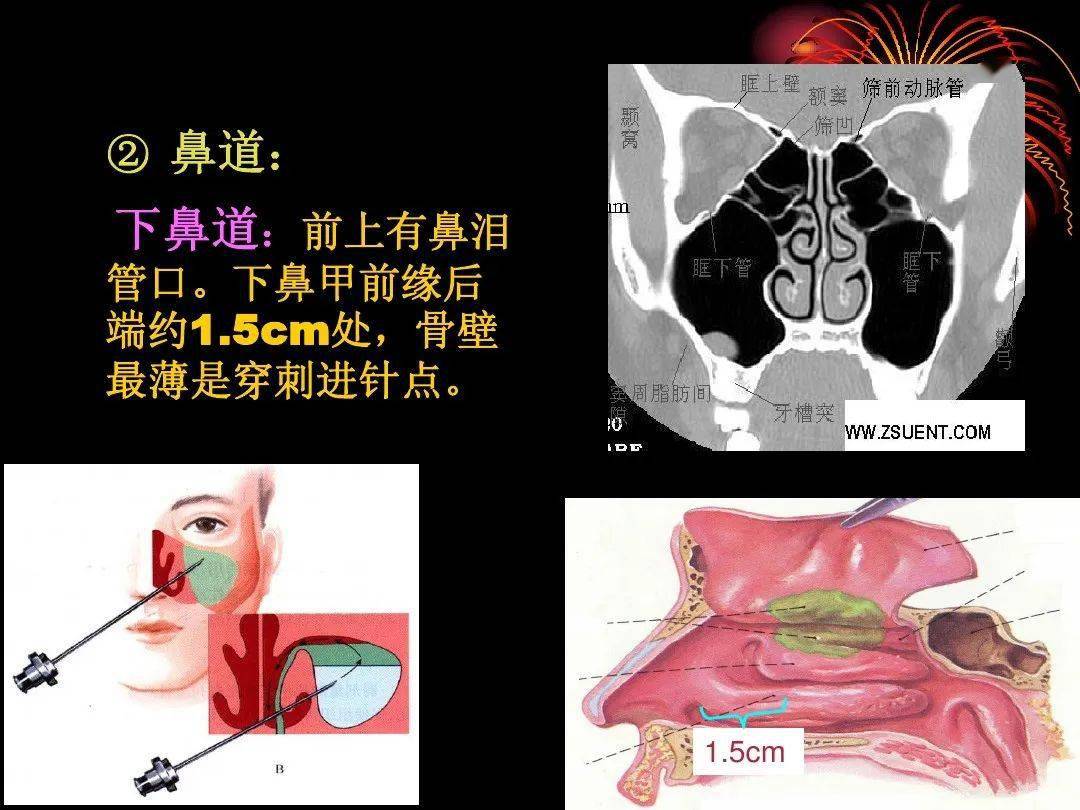 解剖头颈丨鼻部解剖及生理