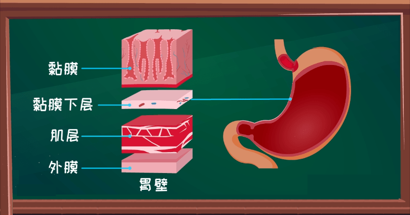 疾病科普丨好好的胃为啥溃疡了带你了解胃溃疡发病机制