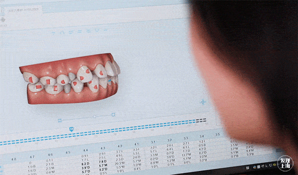 满意地看完初步矫正方案,仅需支付199元定金,就可以开始详细牙齿矫正