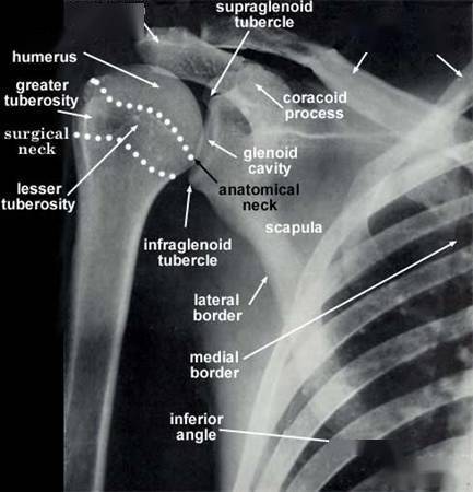 greater tubercle:肱骨大结节  lesser tubercle:肱骨小结节