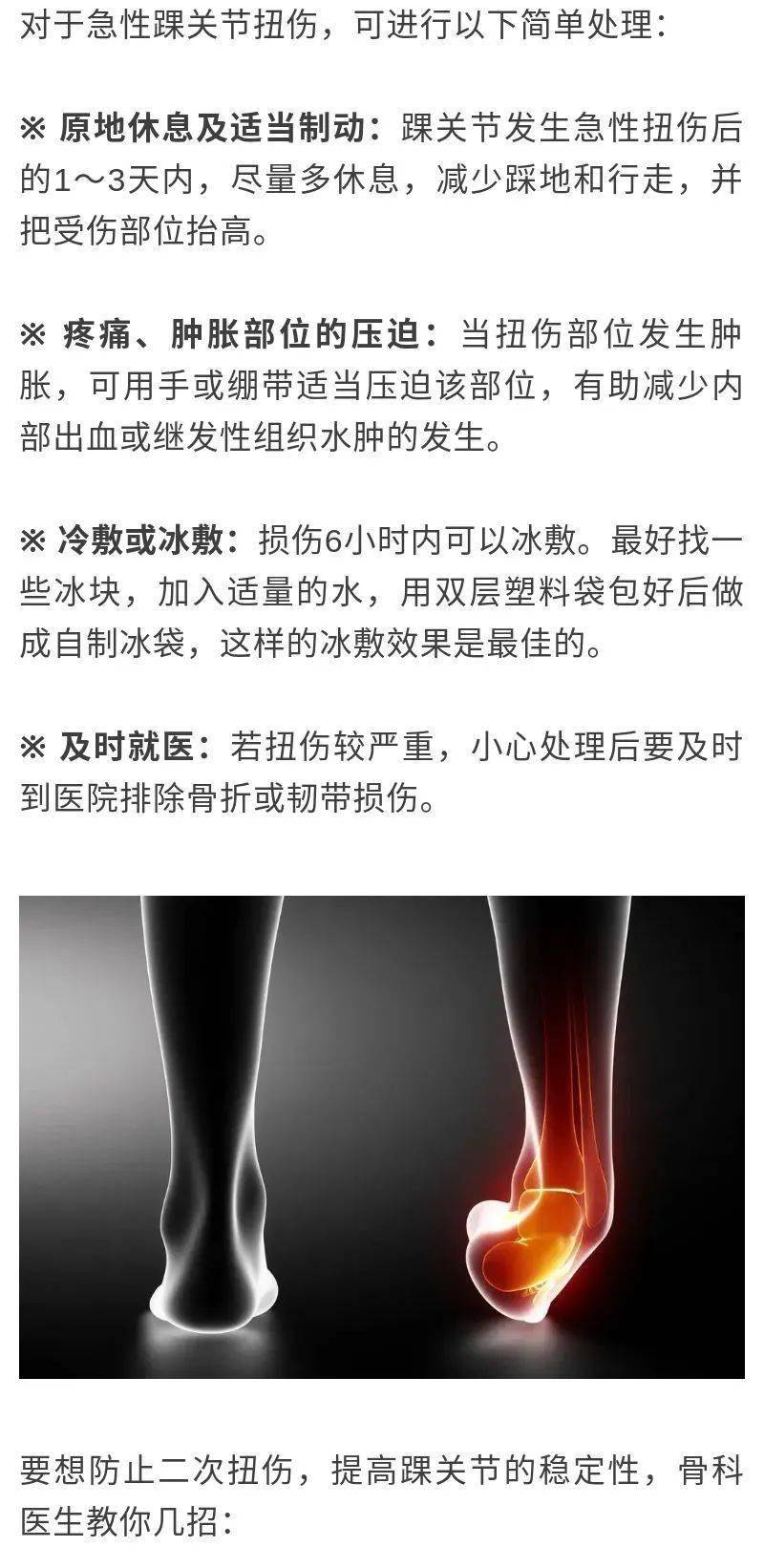 为什么有的人总崴脚?难道身体也有记忆?4个动作可自测踝关节好坏