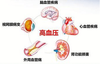 明医识药科学辟谣头晕是高血压的第一信号你真的了解吗