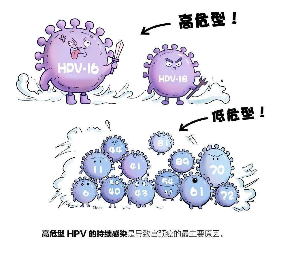 专家教你认识宫颈癌三级预防