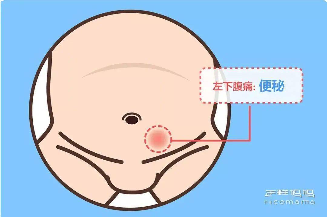 左下腹痛,可能是「便秘」02如果宝宝确实有胃部病症(上腹中线处痛)