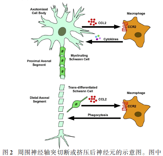 周围神经损伤病理进程中巨噬细胞作用研究进展