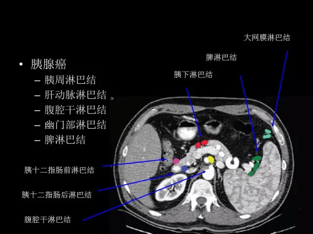 收藏全腹部高清ct图谱淋巴结彩色图谱血管解剖图谱大汇总