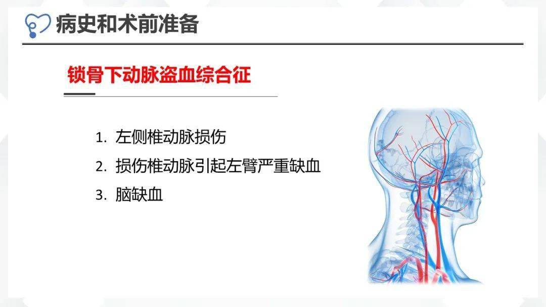 病例讨论 | 寰枢椎脱位合并锁骨下动脉盗血综合征一例
