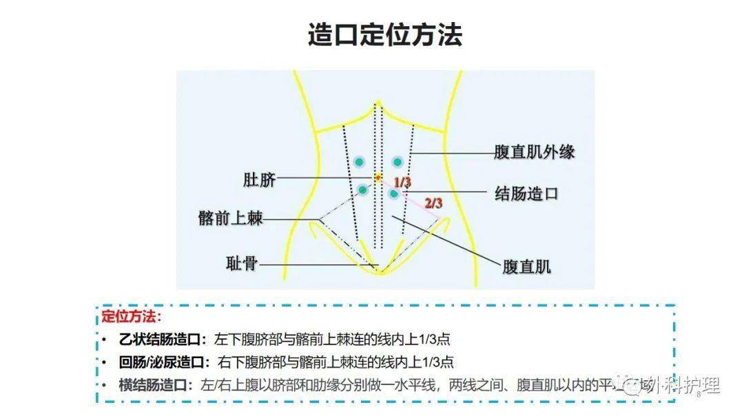 【ppt】造口定位的研究进展——中山大学护理学院