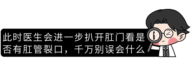 裤子脱了腿张开医院让人脸红的肛门指检竟能查出这么多病