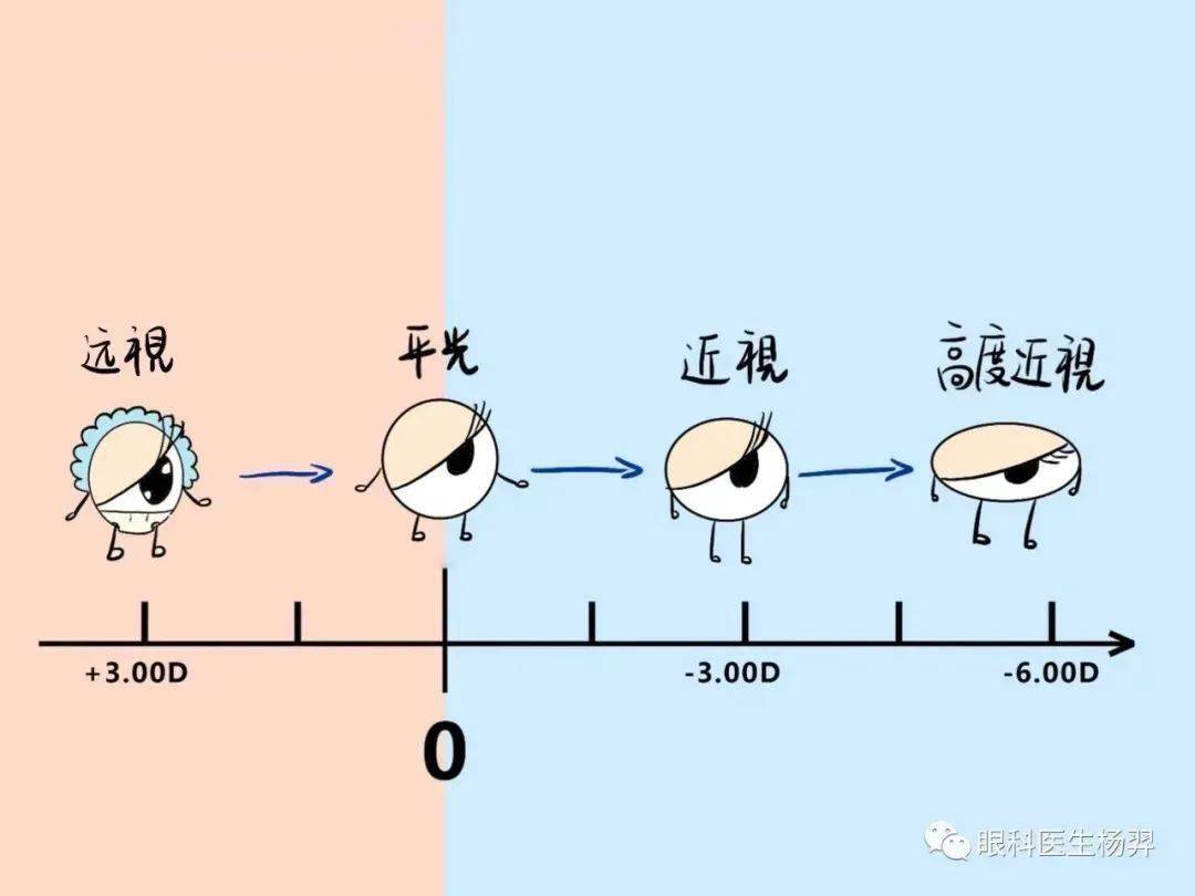 眼科医生杨羿孩子的远视储备越多越不容易近视吗