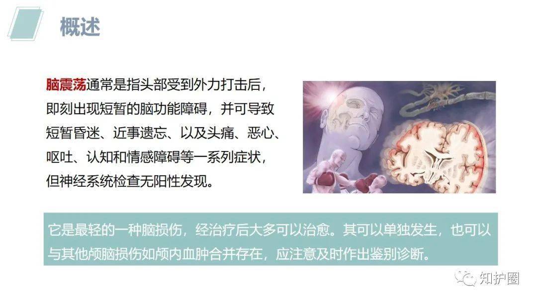 【ppt】脑震荡患者的护理