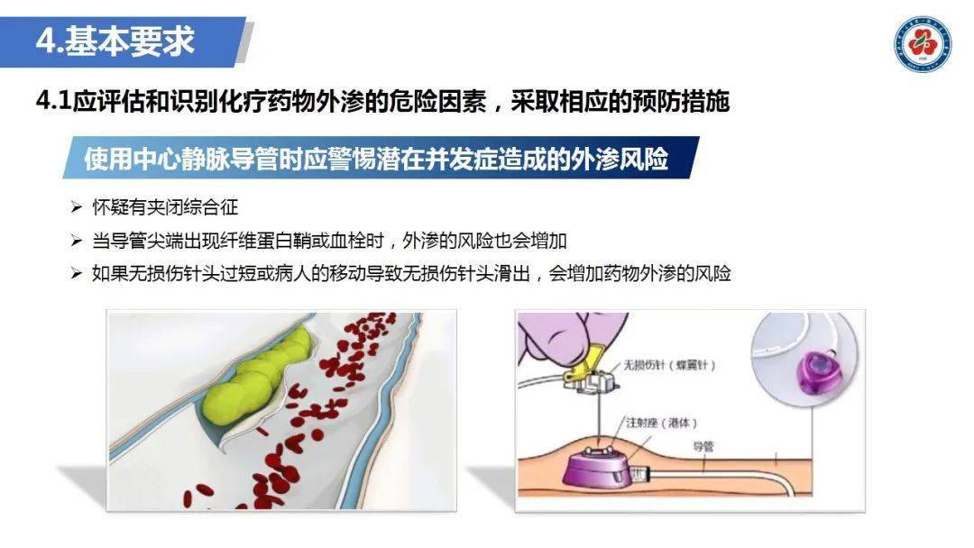 化疗药物外渗预防及处理团体标准解读