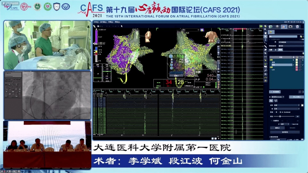 cafs 2021 | 大咖云集·共话消融 房颤手术演示专场邀