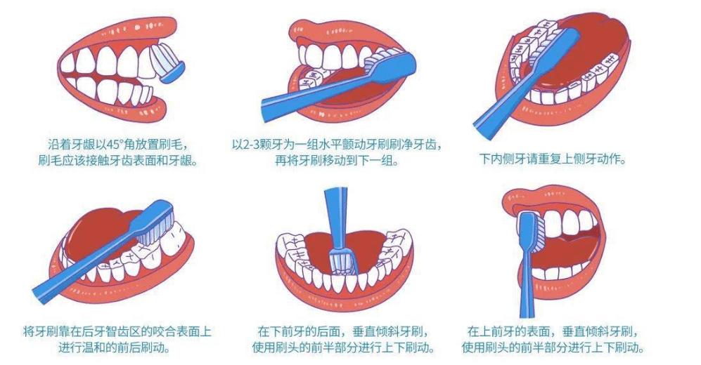 巴氏刷牙法