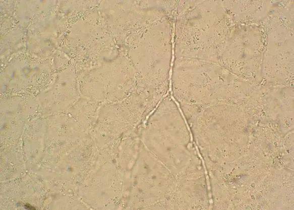 显微镜下真菌菌丝形态