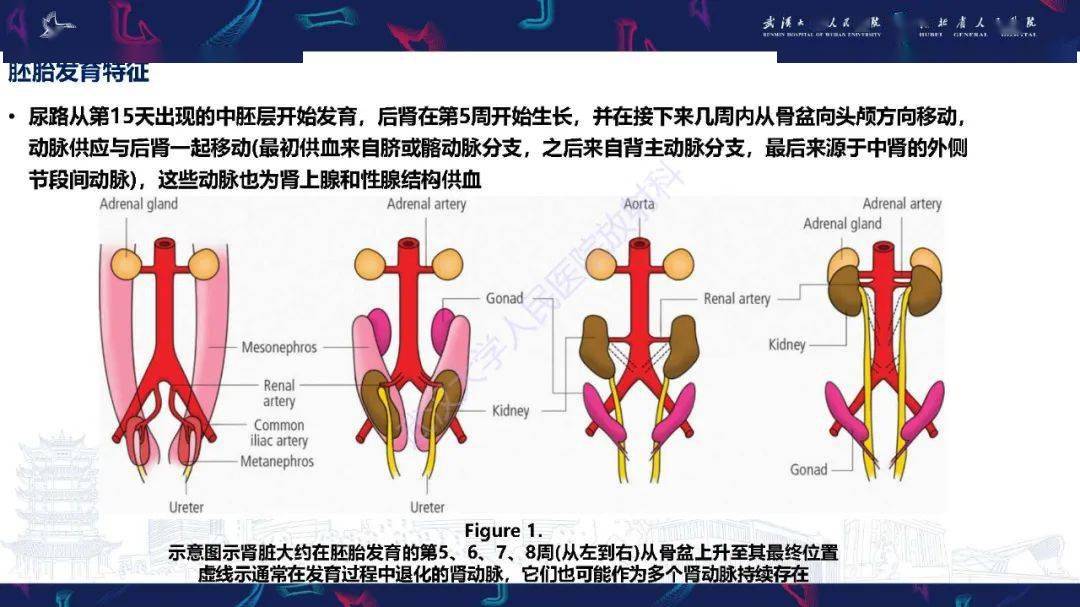 肾动脉解剖病理及血管内治疗