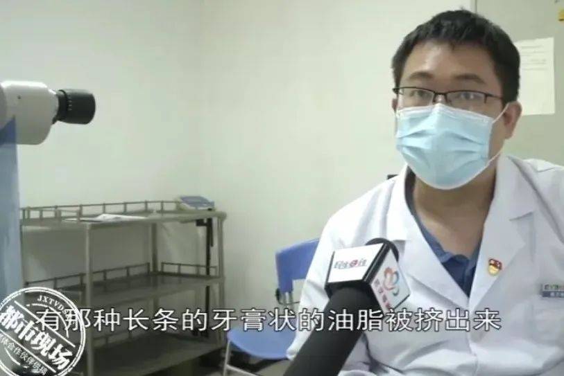 电脑|可能致盲！27岁女子眼皮挤出“牙膏”！这习惯很多人都有…