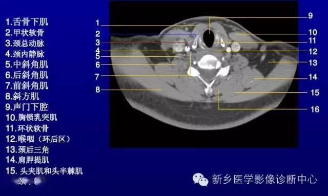 喉部解剖图谱