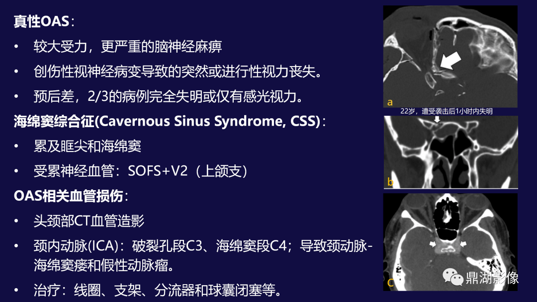 千万不要错过300 神经,头颈系统超全影像文章汇总全网最全头颅影像