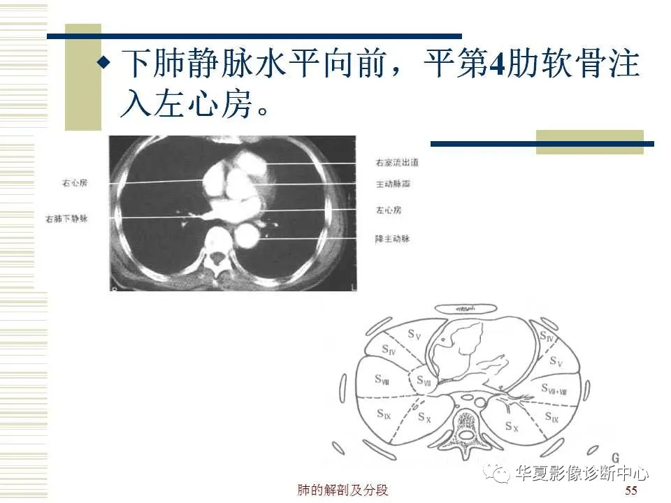 超详尽的心脏大血管影像示意图及肺部解剖与影像