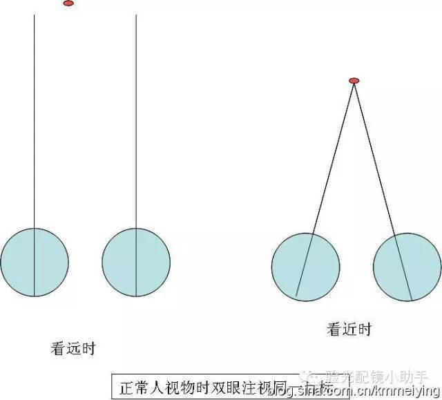 眼位检查_内斜视