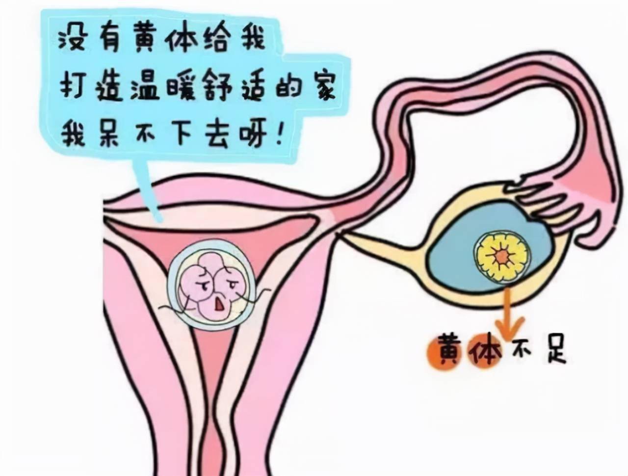 一天接了3个急诊,都是黄体破裂,黄体到底是什么?女性